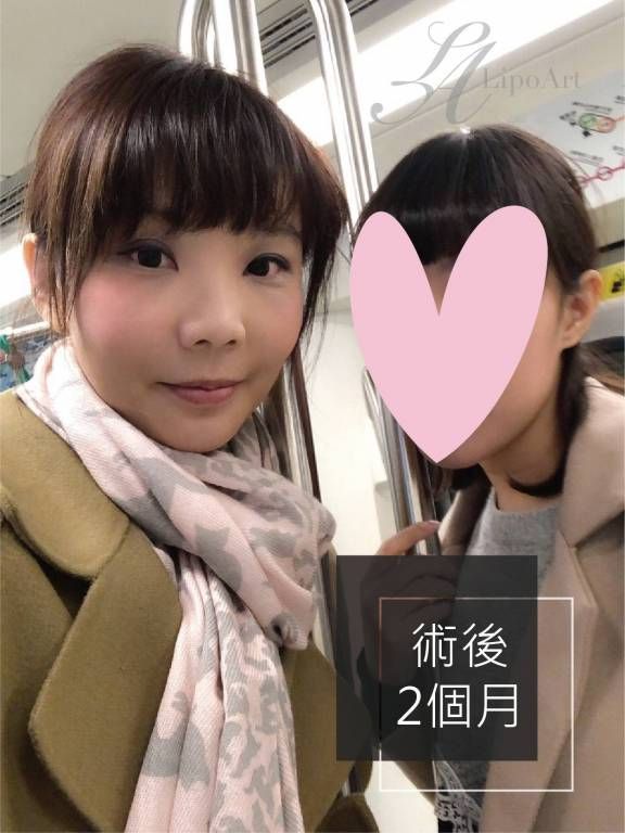 萊波亞