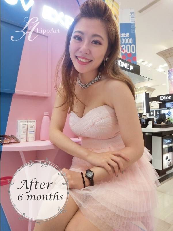 萊波亞