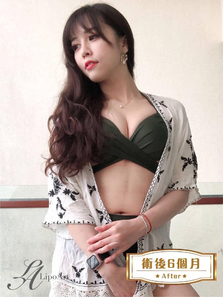 萊波亞