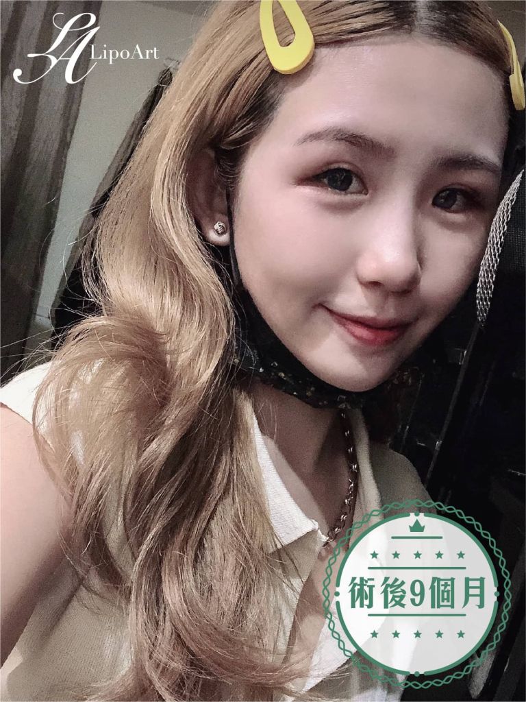萊波亞