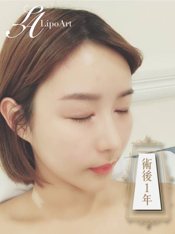 萊波亞