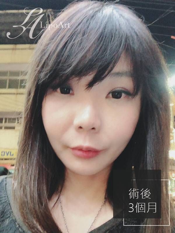 萊波亞