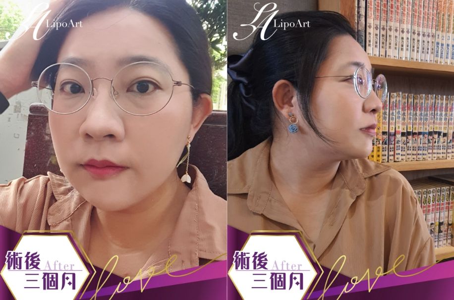 萊波亞