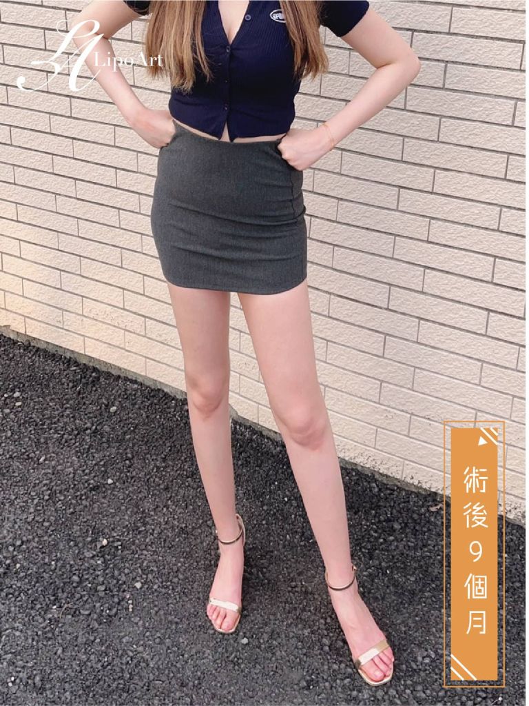 萊波亞