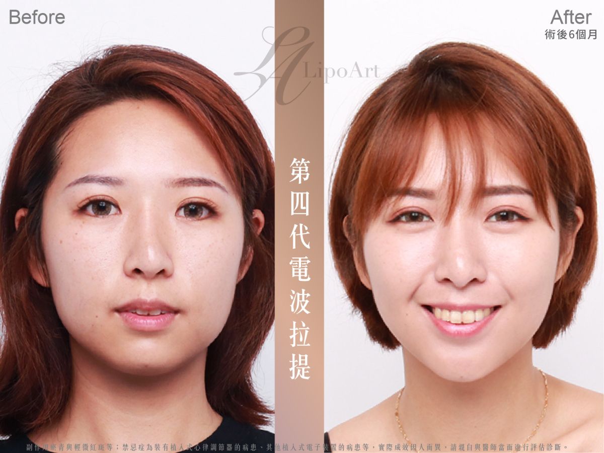 萊波亞