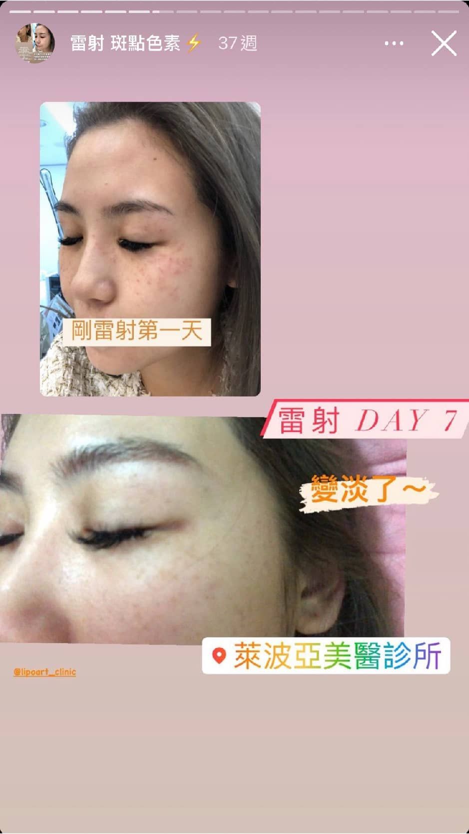 萊波亞