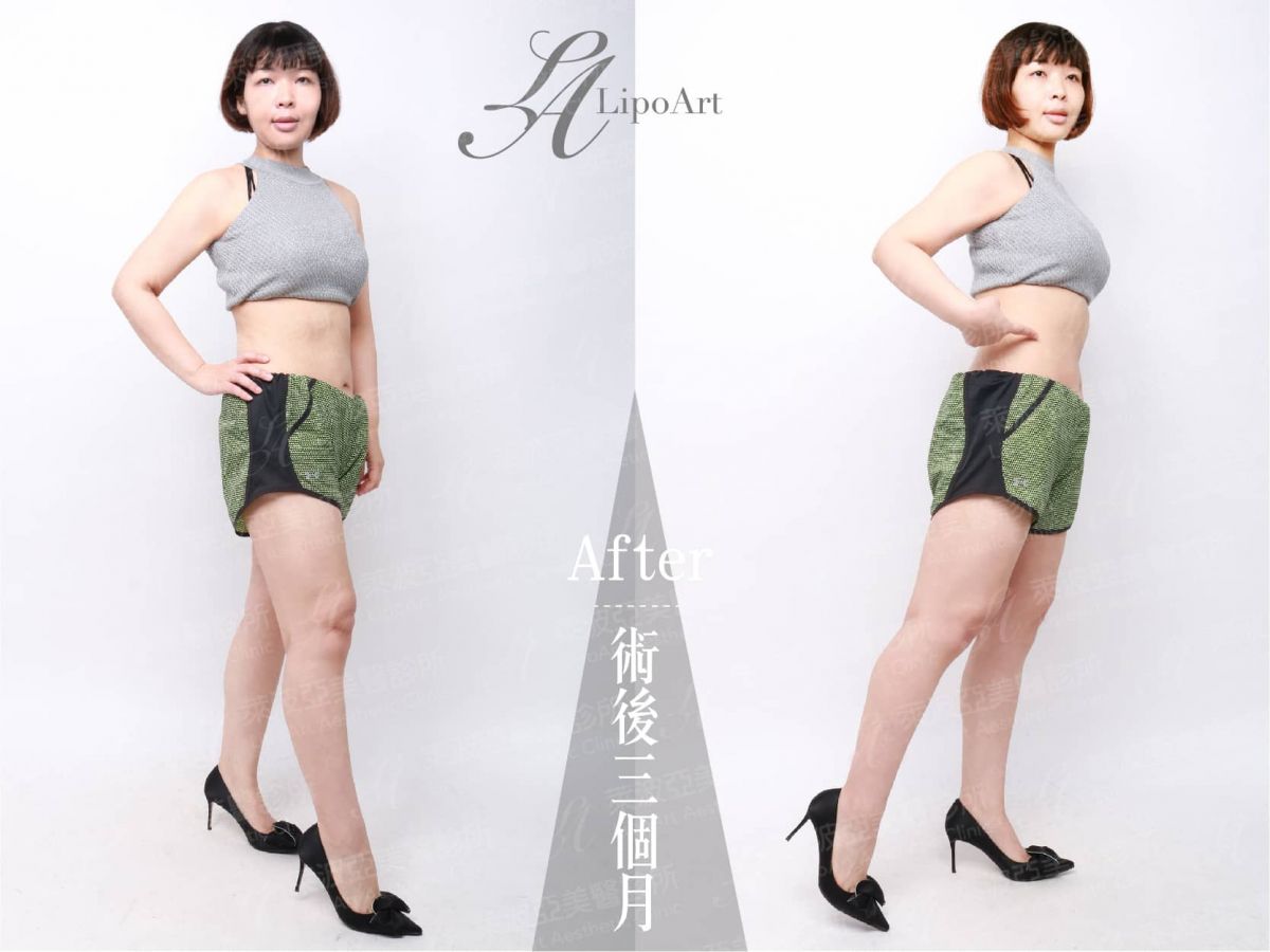 萊波亞
