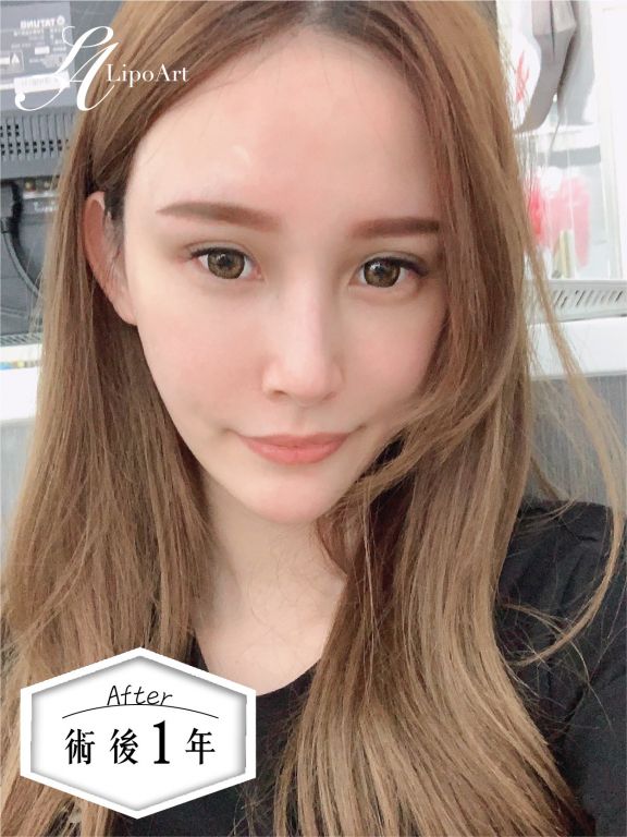 萊波亞