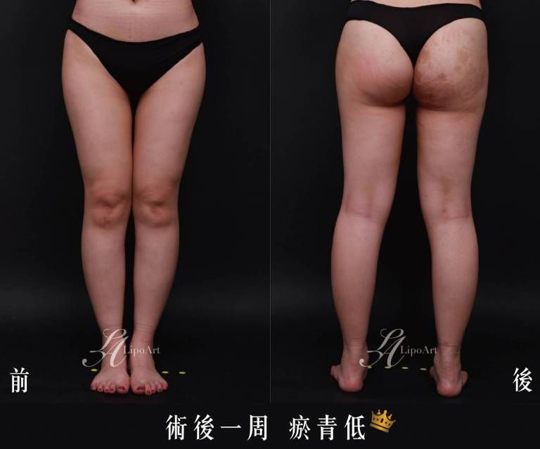 萊波亞