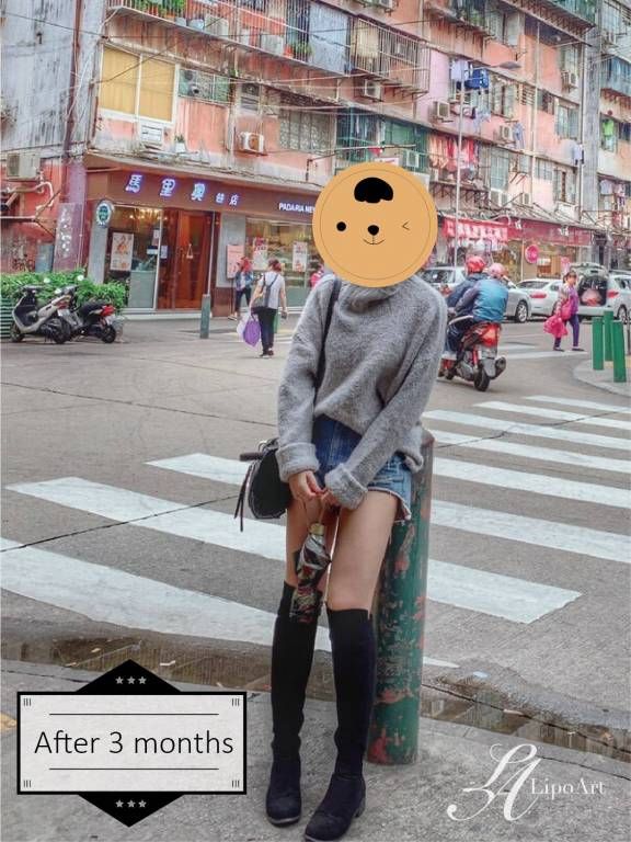 萊波亞