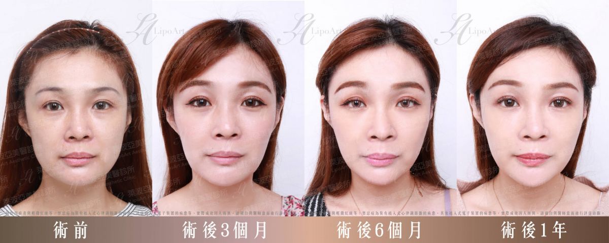 萊波亞