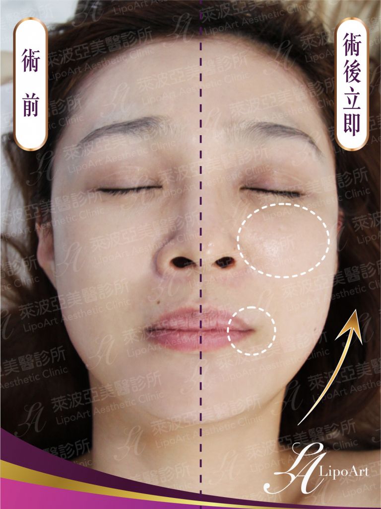 萊波亞