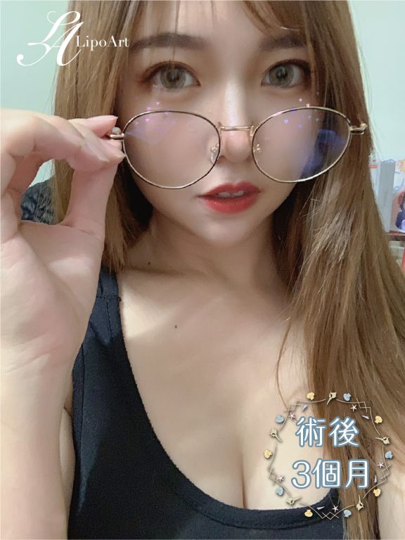 萊波亞