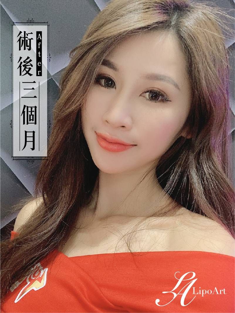 萊波亞