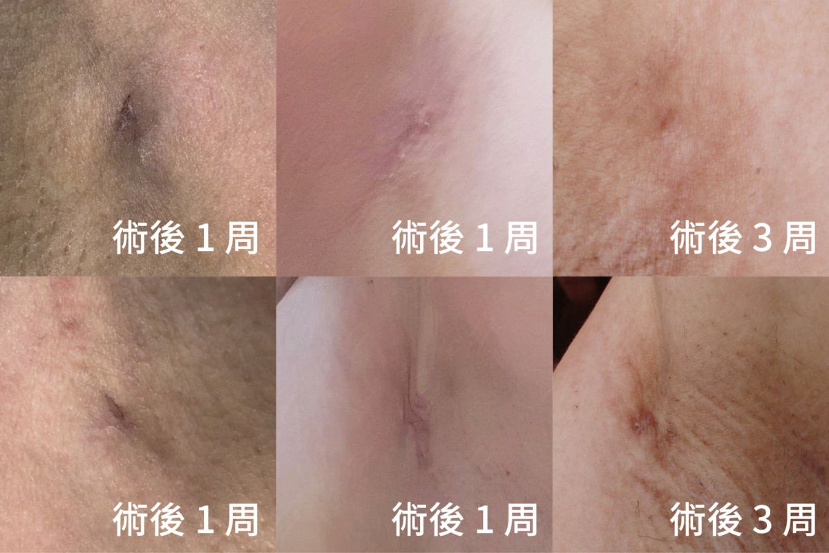 萊波亞