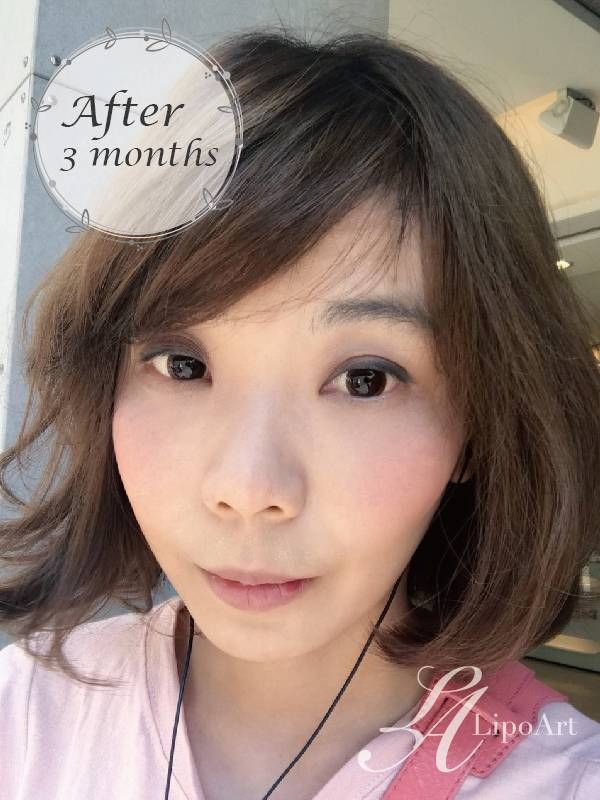 萊波亞