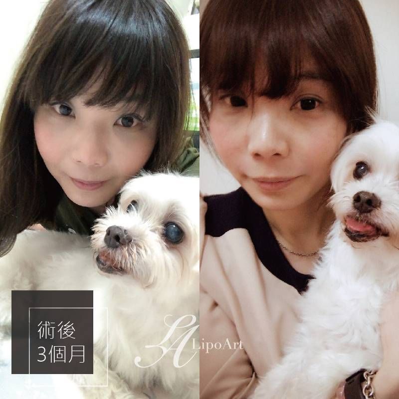萊波亞