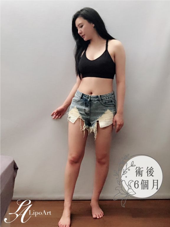 萊波亞