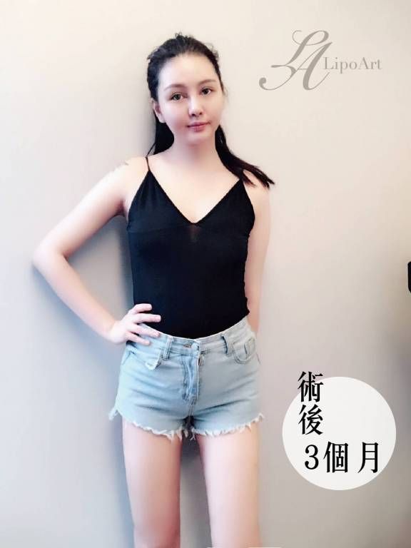 萊波亞