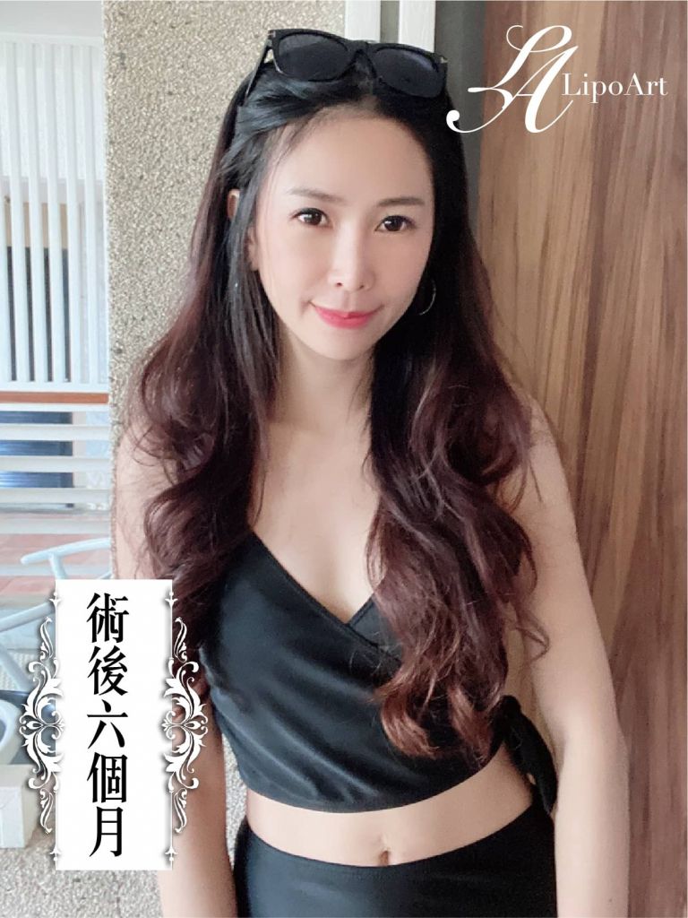 萊波亞