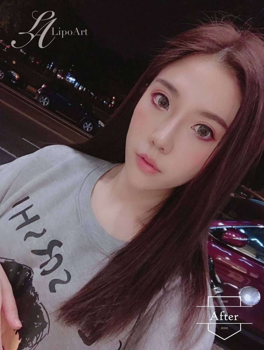 萊波亞