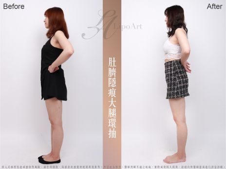 萊波亞 