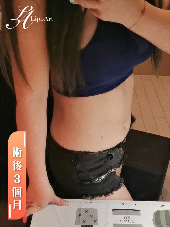 萊波亞