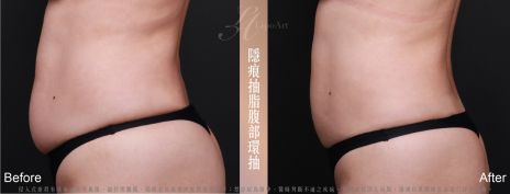 萊波亞 