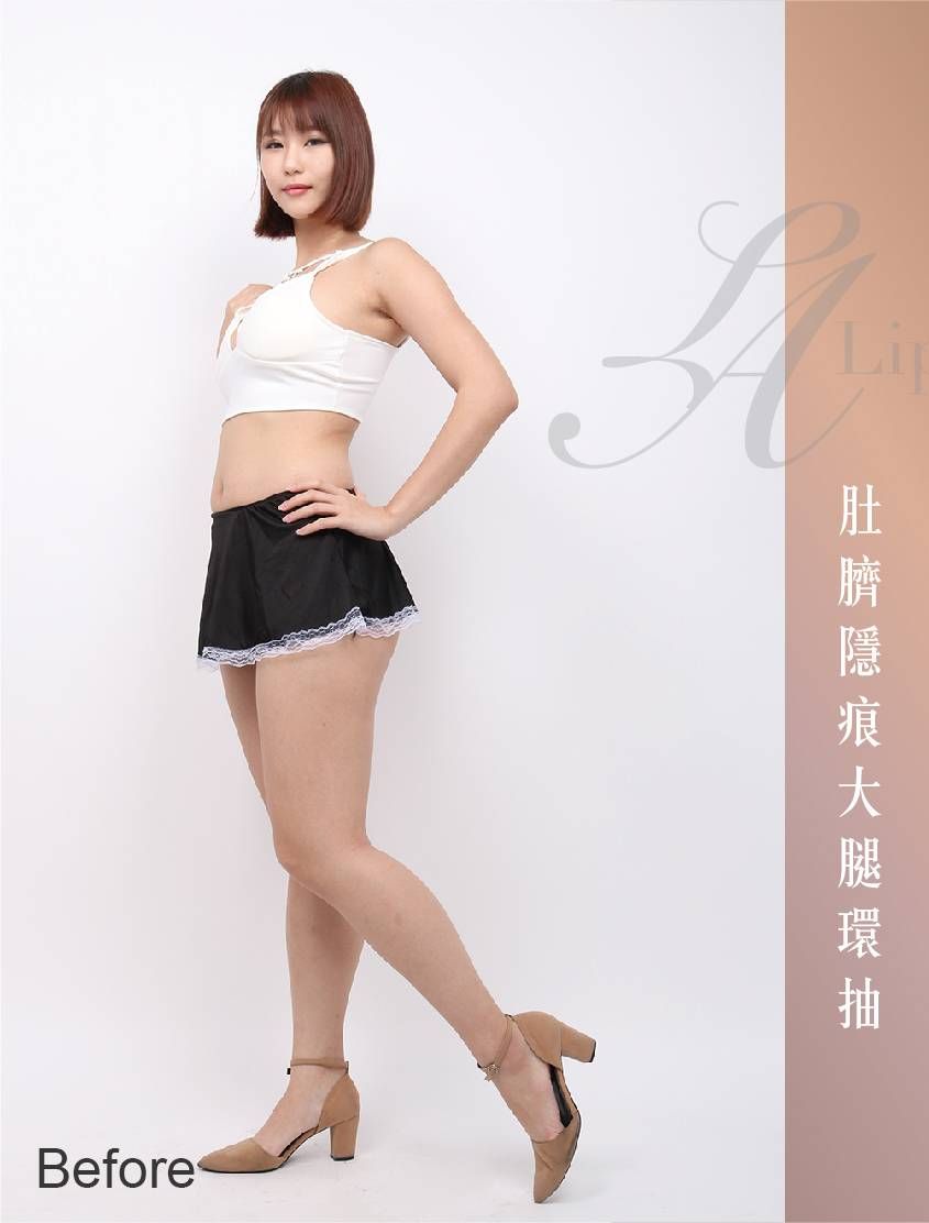 萊波亞 
