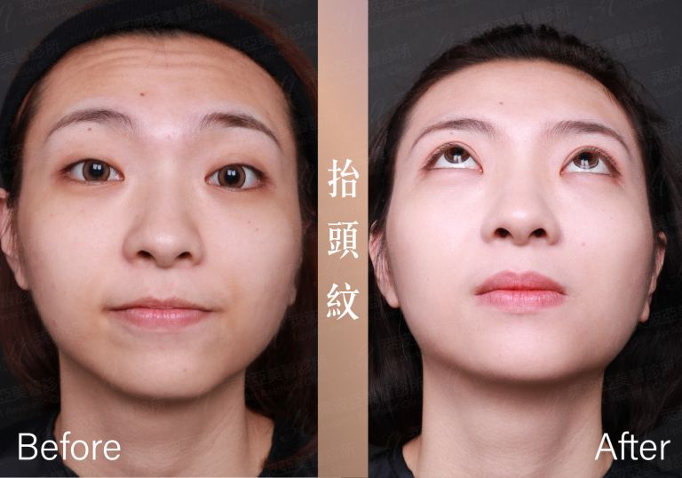 萊波亞