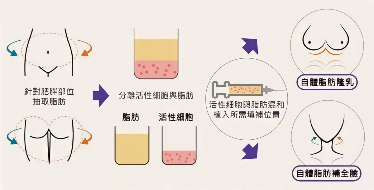 萊波亞