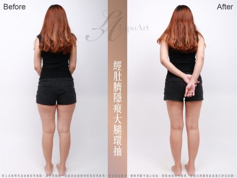 萊波亞 