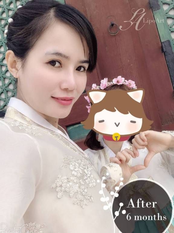 萊波亞