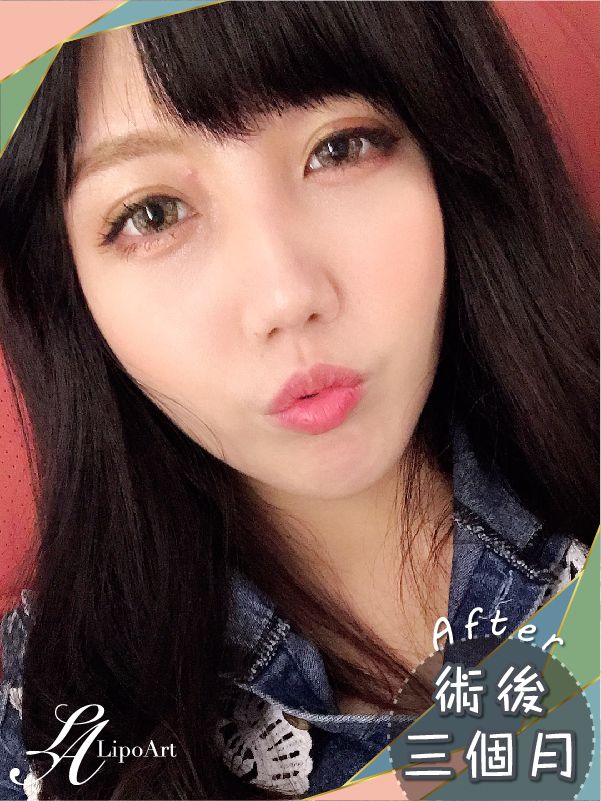 萊波亞