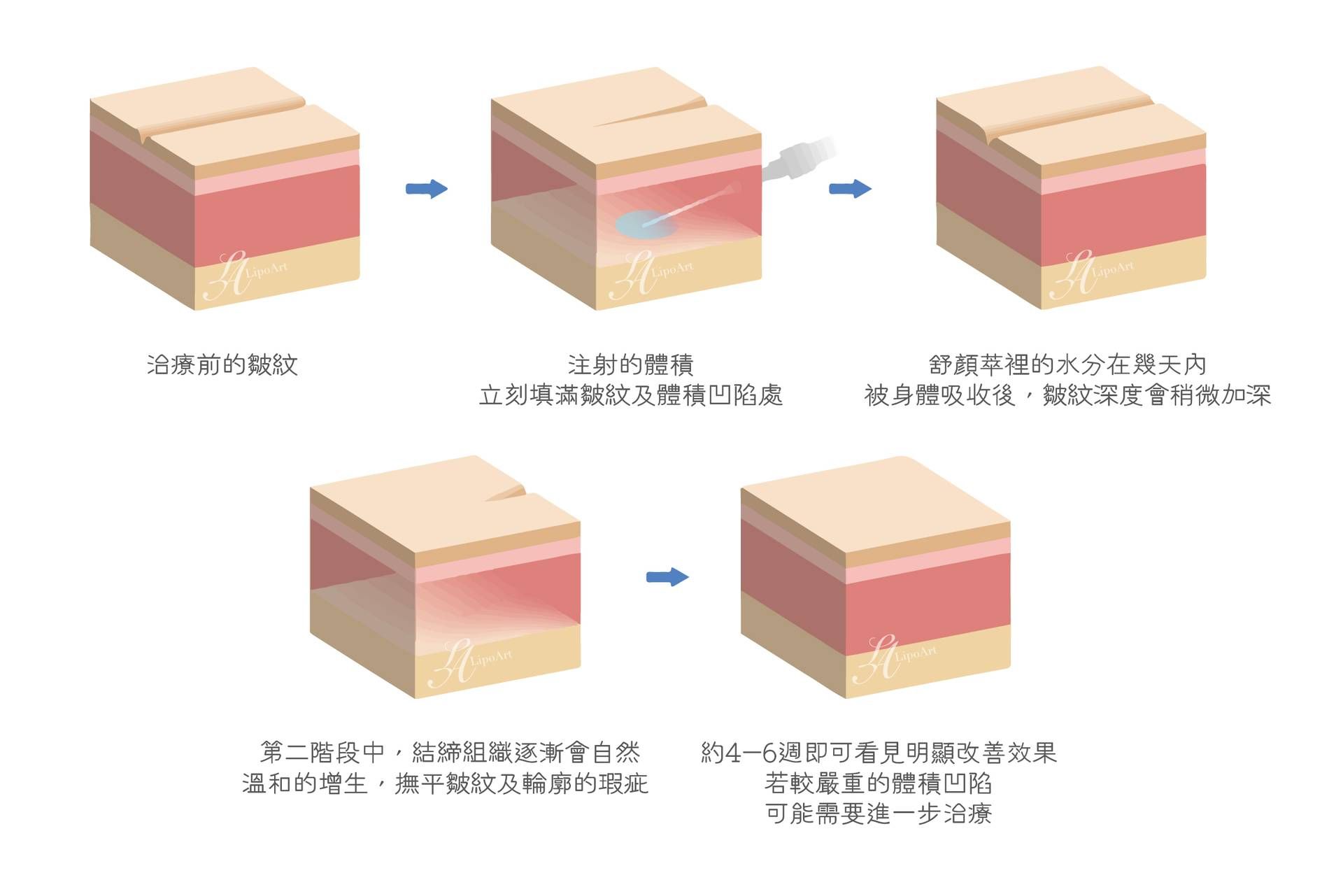 萊波亞