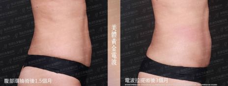 萊波亞 