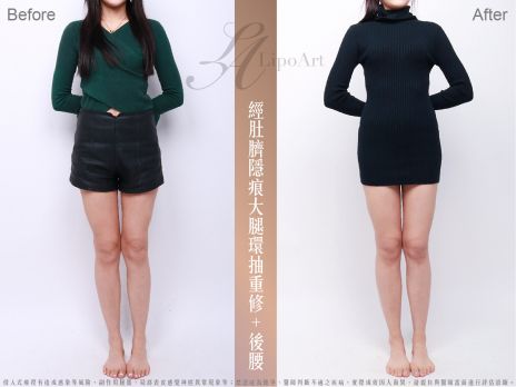 萊波亞 