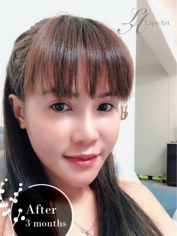 萊波亞