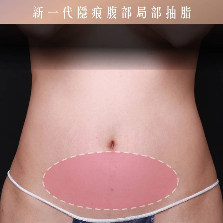 萊波亞