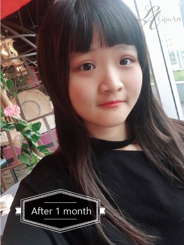 萊波亞