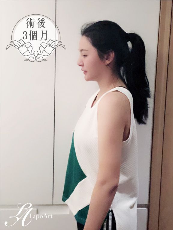 萊波亞