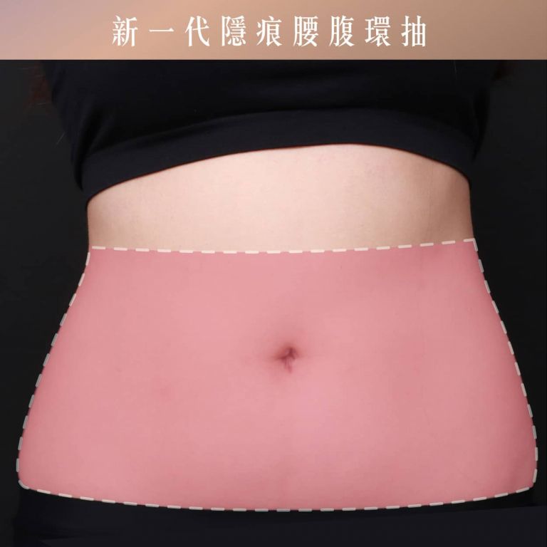 萊波亞