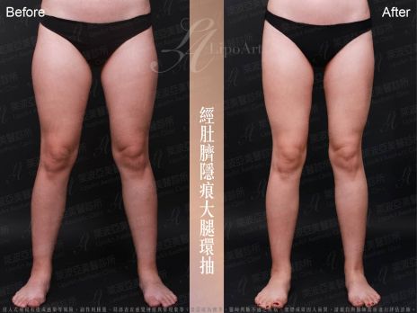 萊波亞 