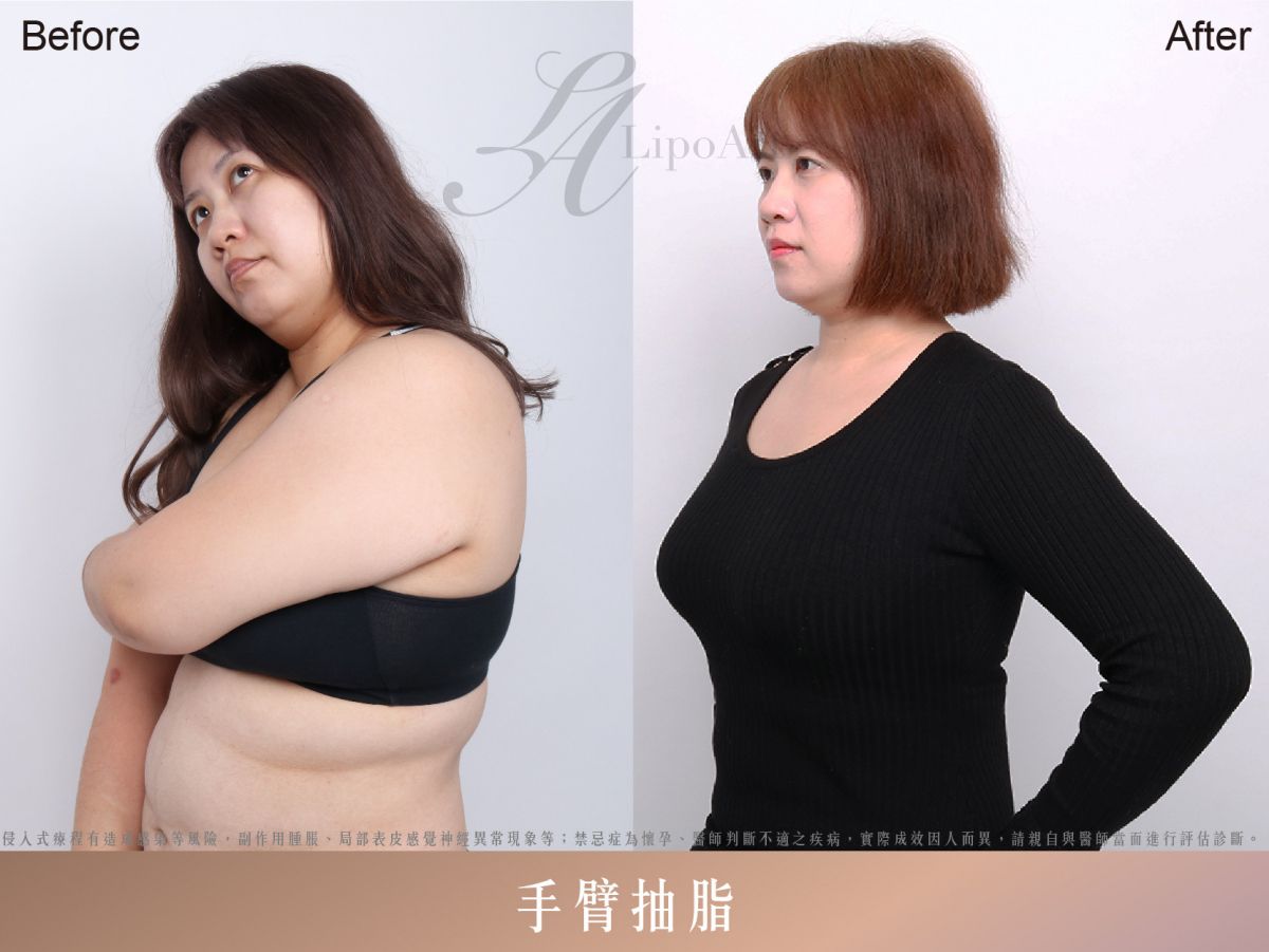 萊波亞
