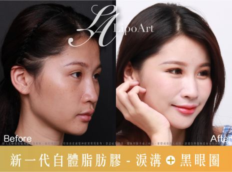 萊波亞 