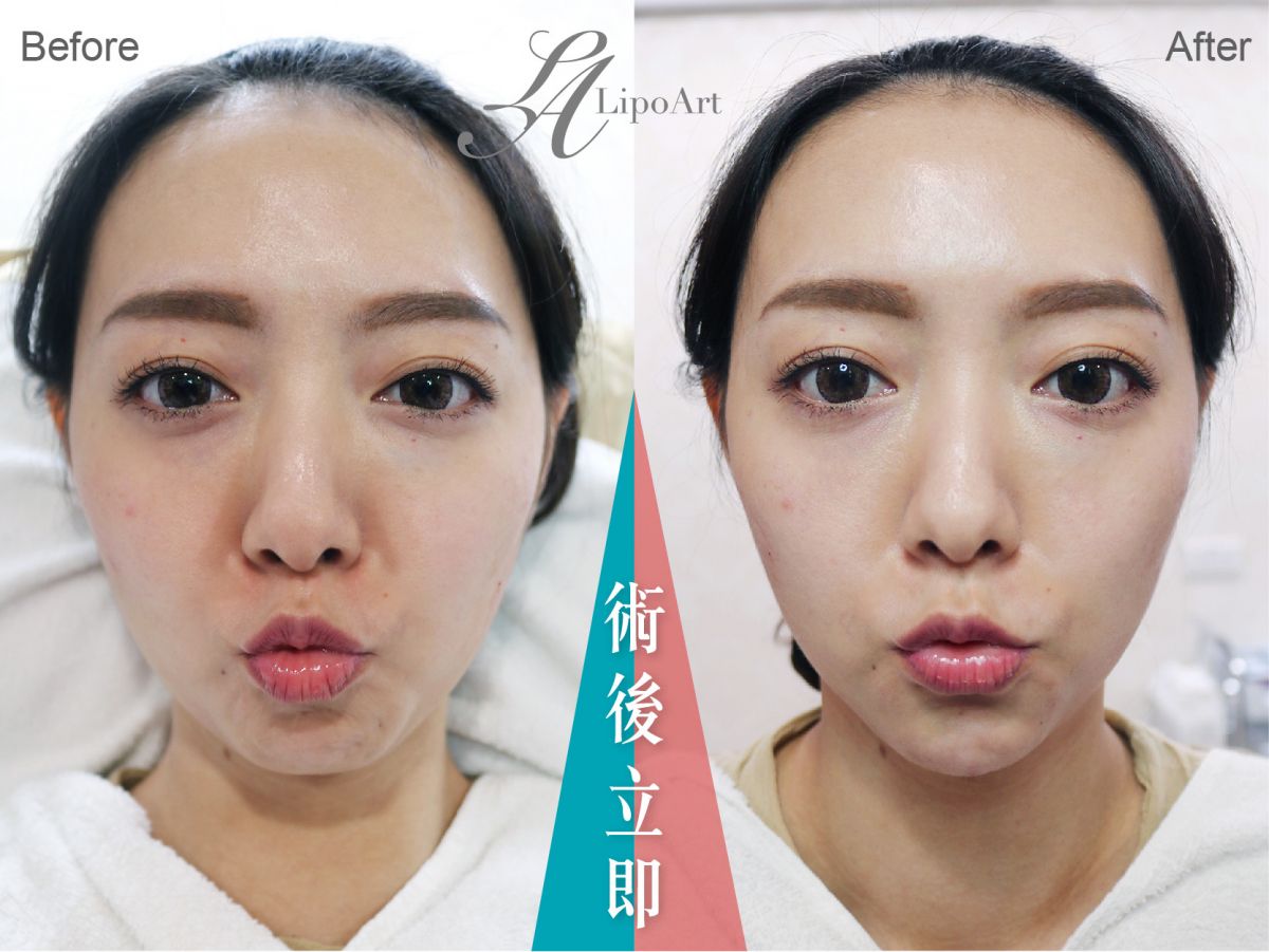 萊波亞