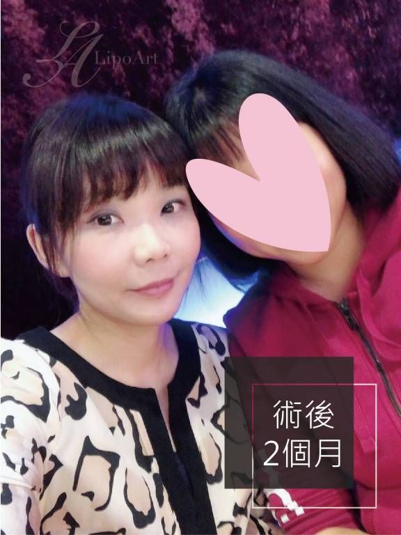 萊波亞
