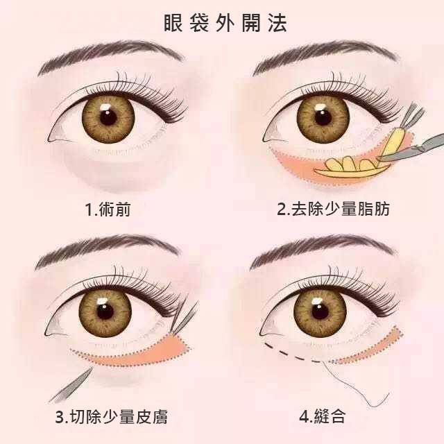 萊波亞