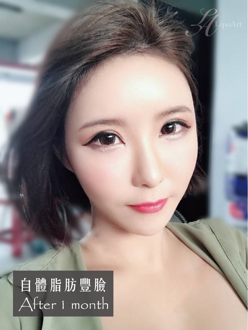 萊波亞