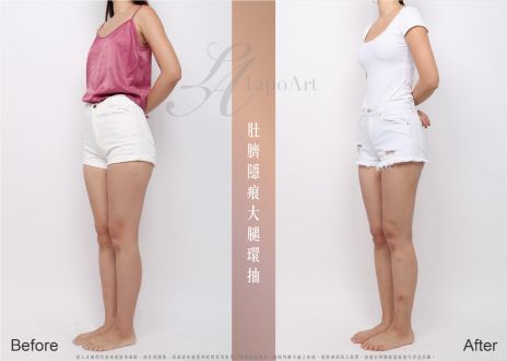 萊波亞 